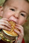 Az elhízott gyerekek artériái 30 évvel idõsebbek naptári koruknál