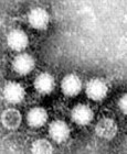Hepatitis E vírusfertõzések már Európában is