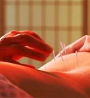 Az akupunktúra jótékonyan hat a nõk termékenységére?
