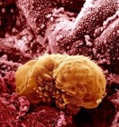 Lehetõvé teszik, hogy tudományos céllal humán embriókat klónozzanak