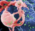 Leírták a HIV-fertõzésben kulcsfontosságú fehérje térszerkezetét    