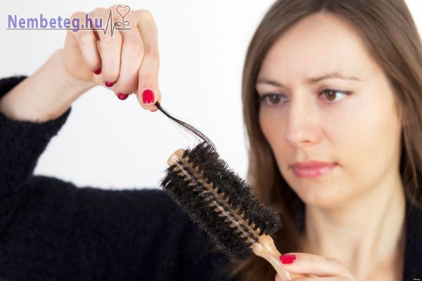 A hajhullás hátterében meghúzódó problémák