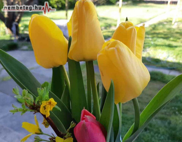 Tavasz, sárga tulipán