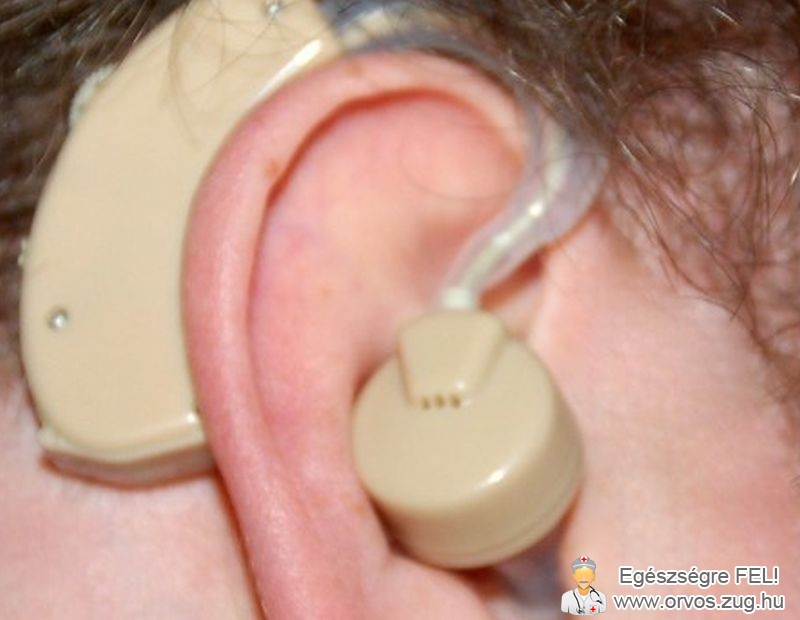 Hallókészülék