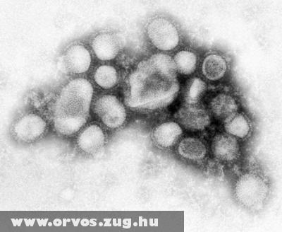 H1N1 víruskép