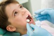 Rendszeres fogászati szűréssel több későbbi megbetegedést is elkerülhetünk